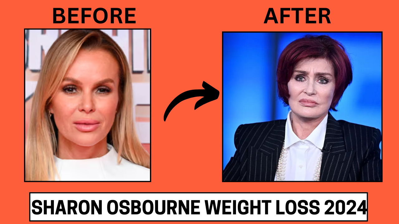 Sharon Osbourne Weight Loss 2024